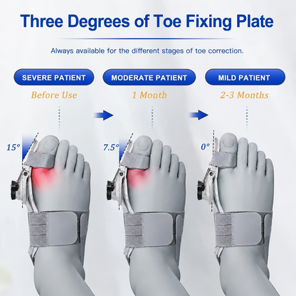 Adjustable Bunion Corrector for Pain Relief
